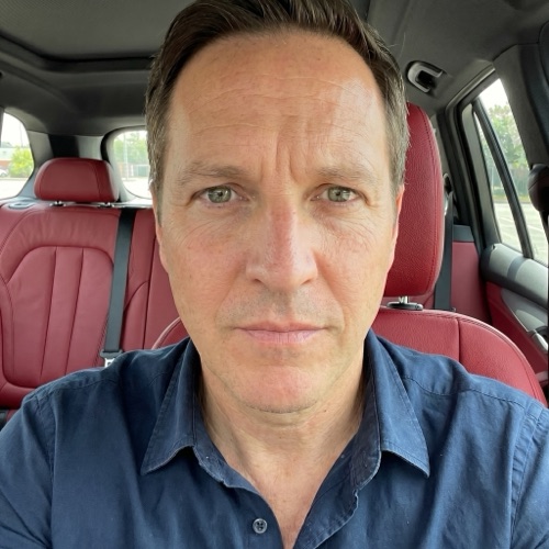 DermLens AI before-and-after — user 5, after photo showing skin improvement following AI-generated routine